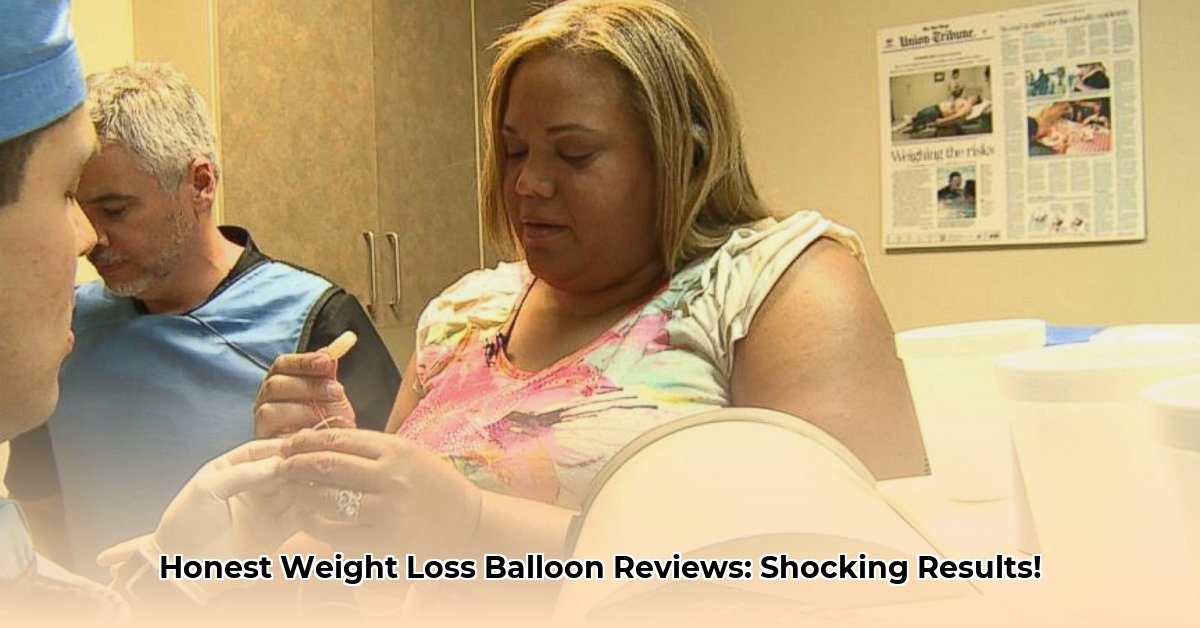 weight-loss-balloon-reviews